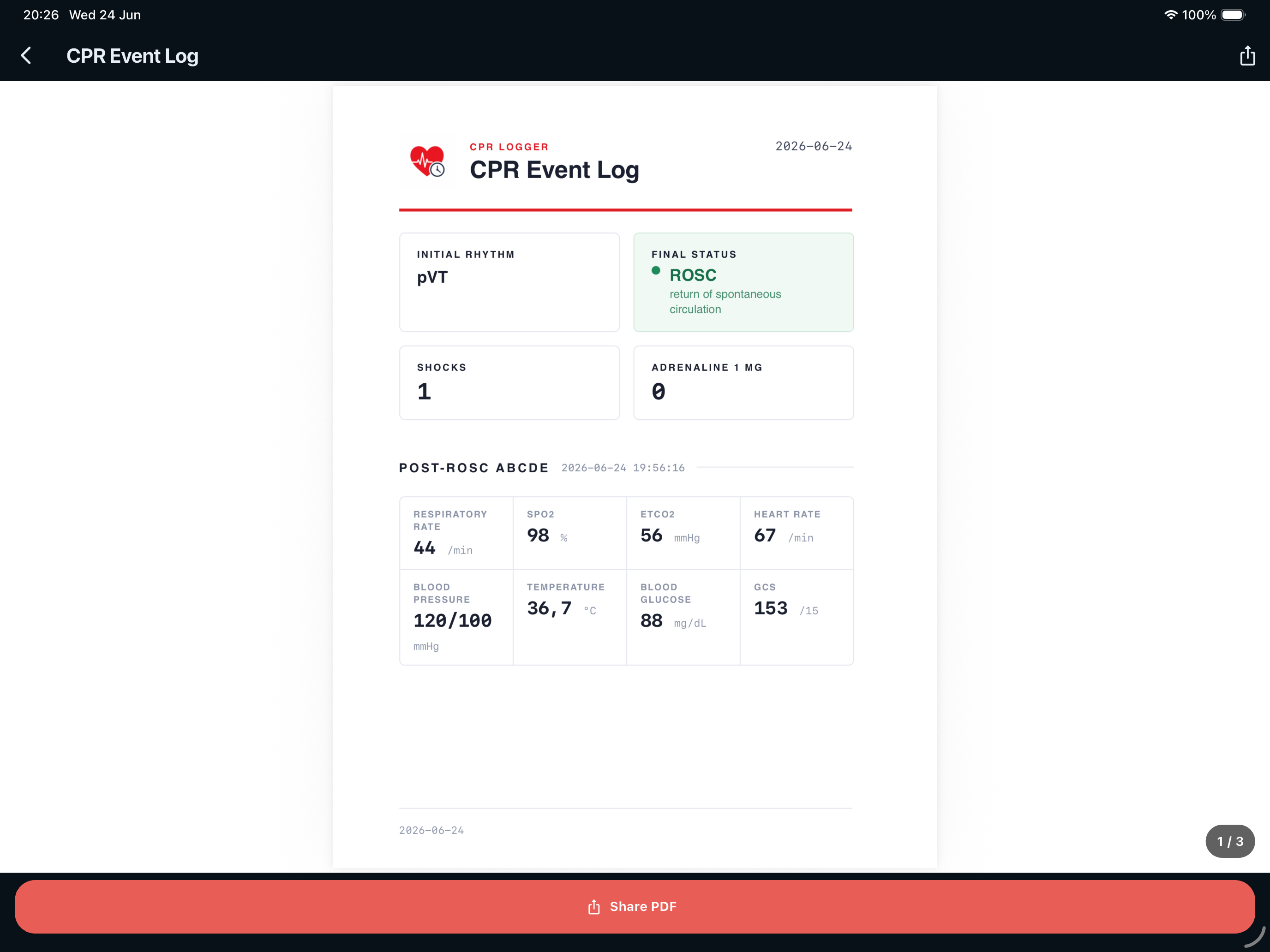 CPR Logger on iPad — event log report